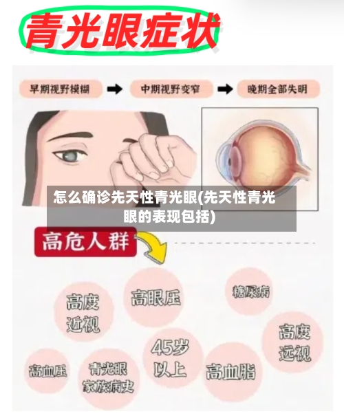 怎么确诊先天性青光眼(先天性青光眼的表现包括)