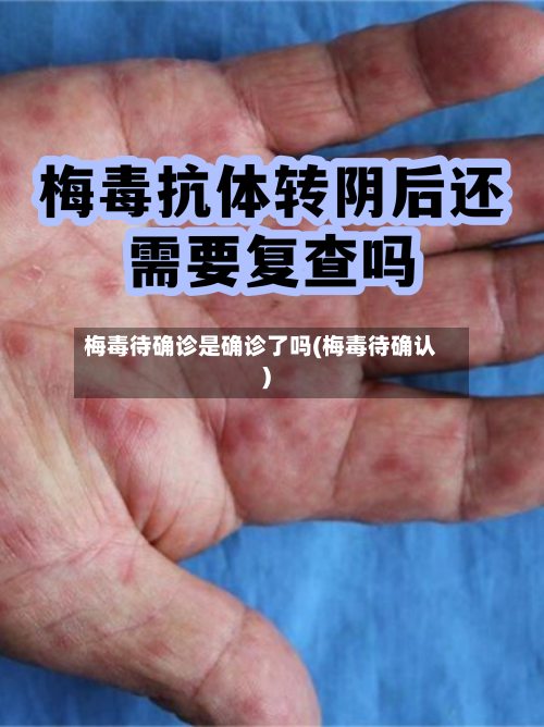 梅毒待确诊是确诊了吗(梅毒待确认)